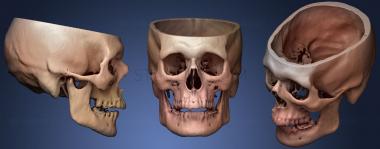 3D модель Череп Мужской 43лет (STL)